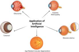 AI in Ophthalmology